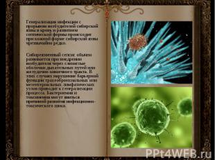 Генерализация инфекции с прорывом возбудителей сибирской язвы в кровь и развитие