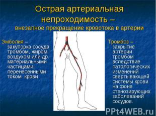 Острая артериальная непроходимость – внезапное прекращение кровотока в артерии Э