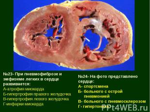 №23- При пневмофиброзе и эмфиземе легких в сердце развивается: А-атрофия миокард