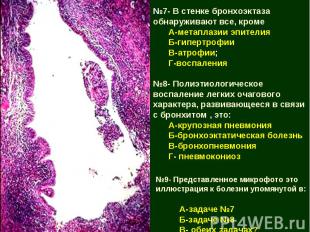 №7- В стенке бронхоэктаза обнаруживают все, кроме А-метаплазии эпителия Б-гиперт