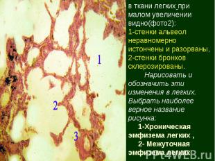 в ткани легких при малом увеличении видно(фото2): 1-стенки альвеол неравномерно