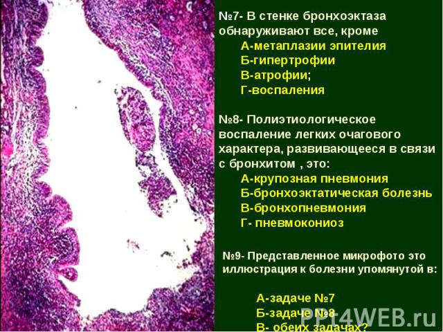 №7- В стенке бронхоэктаза обнаруживают все, кроме А-метаплазии эпителия Б-гипертрофии В-атрофии; Г-воспаления №8- Полиэтиологическое воспаление легких очагового характера, развивающееся в связи с бронхитом , это: А-крупозная пневмония Б-бронхоэктати…