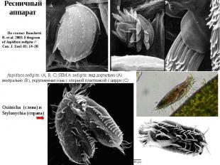 Aspidisca sedigita. (A, B, C) SEM A. sedigita: вид дорзально (A) вентрально (B),