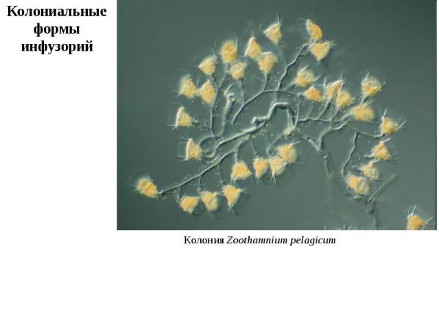 Колония Zoothamnium pelagicum Колониальные формы инфузорий