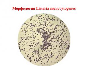 Морфология Listeria monocytogenes