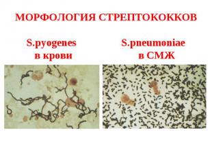 МОРФОЛОГИЯ СТРЕПТОКОККОВ S.pyogenes S.pneumoniae в крови в СМЖ