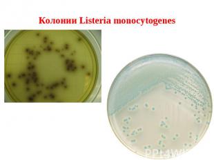 Колонии Listeria monocytogenes