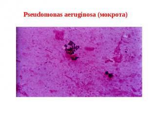 Pseudomonas aeruginosa (мокрота)