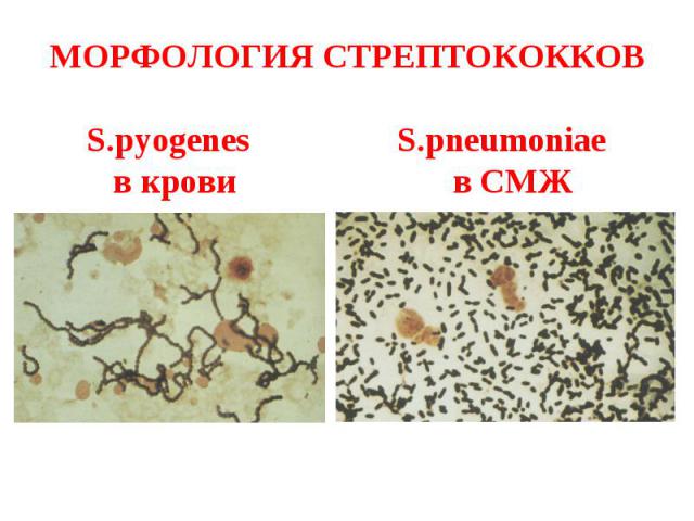 МОРФОЛОГИЯ СТРЕПТОКОККОВ S.pyogenes S.pneumoniae в крови в СМЖ