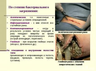Асептическая резаная рана Гнойная рана с обилием некротических тканей По степени