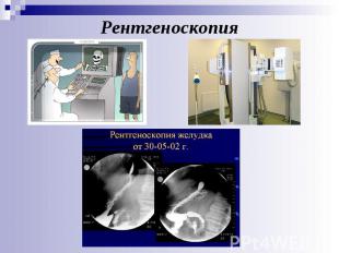 Рентгеноскопия
