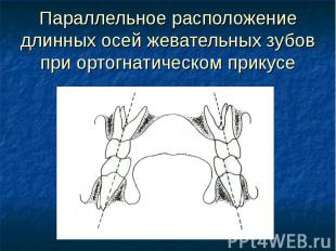 Параллельное расположение длинных осей жевательных зубов при ортогнатическом при