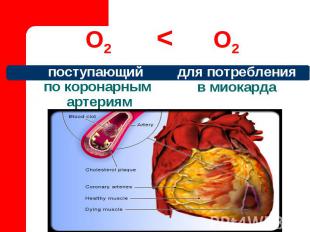 О2 < О2 для потребления в миокарда поступающий по коронарным артериям