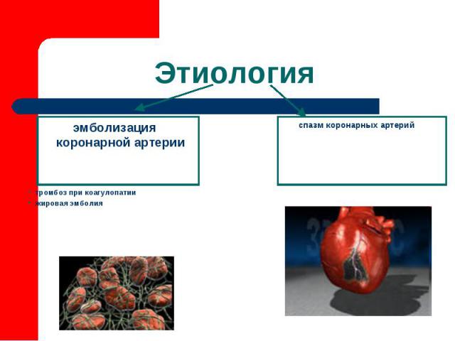 эмболизация коронарной артерии спазм коронарных артерий тромбоз при коагулопатии жировая эмболия Этиология