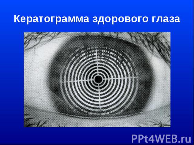 Кератограмма здорового глаза