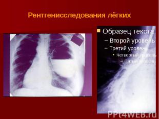 Рентгенисследования лёгких