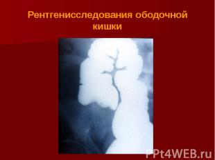Рентгенисследования ободочной кишки