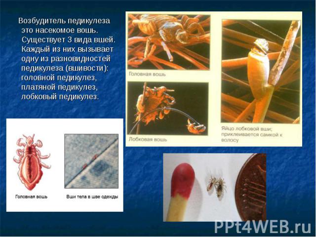 Возбудитель педикулеза это насекомое вошь. Существует 3 вида вшей. Каждый из них вызывает одну из разновидностей педикулеза (вшивости): головной педикулез, платяной педикулез, лобковый педикулез.