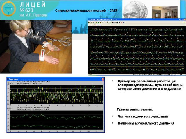 Спироартериокардиоритмограф - САКР Пример одновременной регистрации электрокардиограммы, пульсовой волны артериального давления и фаз дыхания Пример ритмограммы: Частота сердечных сокращений Величины артериального давления