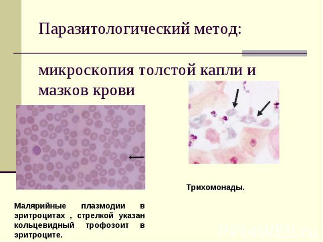 Паразитологический метод: микроскопия толстой капли и мазков крови