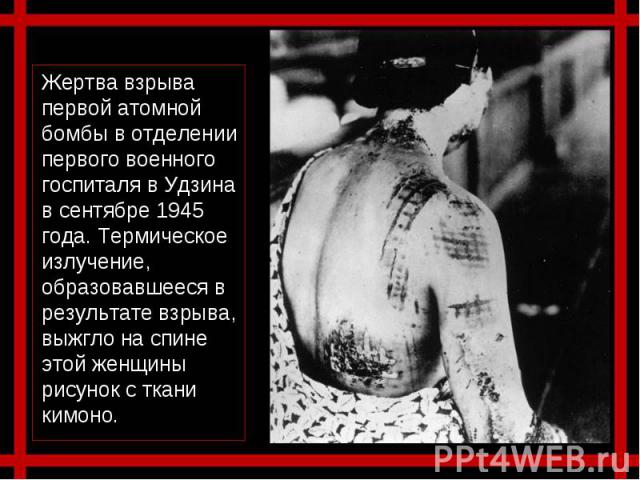 Жертва взрыва первой атомной бомбы в отделении первого военного госпиталя в Удзина в сентябре 1945 года. Термическое излучение, образовавшееся в результате взрыва, выжгло на спине этой женщины рисунок с ткани кимоно.