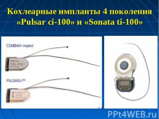 Кохлеарные импланты 4 поколения«Pulsar ci-100» и «Sonata ti-100»