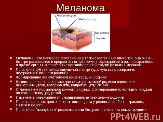 Меланома Меланома - это наиболее агрессивная из злокачественных опухолей, она очень быстро развивается и прорастает вглубь кожи, повреждая ее и распространяясь в другие органы. Характерные признаки ранней стадии развития меланомыПоявление субъективн…