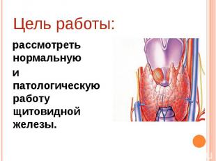 Цель работы: рассмотреть нормальную и патологическую работу щитовидной железы.