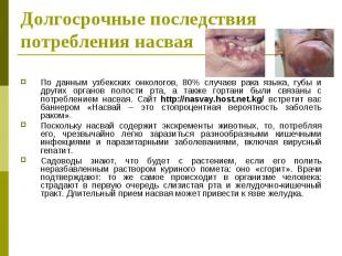 По данным узбекских онкологов, 80% случаев рака языка, губы и других органов пол