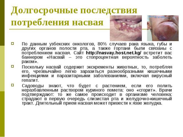 По данным узбекских онкологов, 80% случаев рака языка, губы и других органов полости рта, а также гортани были связаны с потреблением насвая. Сайт http://nasvay.host.net.kg/ встретит вас баннером «Насвай – это стопроцентная вероятность заболеть рако…