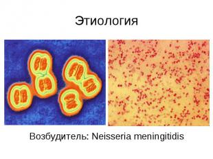 Этиология Возбудитель: Neisseria meningitidis