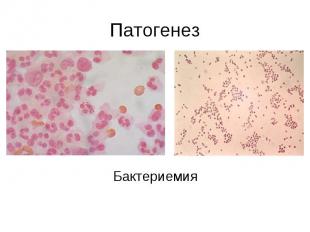 Патогенез Бактериемия