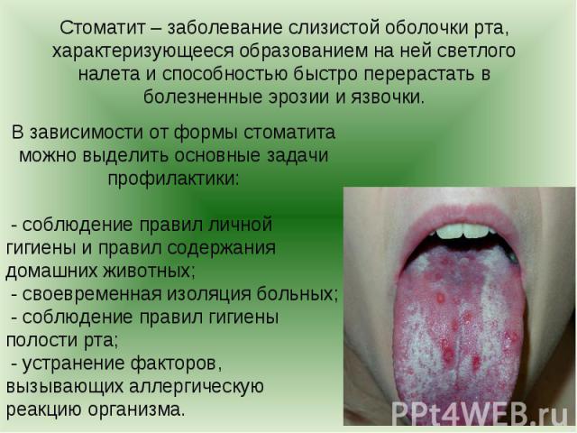 Стоматит – заболевание слизистой оболочки рта, характеризующееся образованием на ней светлого налета и способностью быстро перерастать в болезненные эрозии и язвочки. Стоматит – заболевание слизистой оболочки рта, характеризующееся образованием на н…