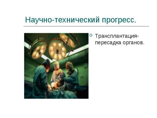 Научно-технический прогресс. Трансплантация- пересадка органов.