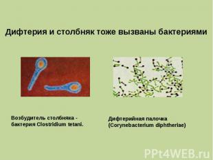 Дифтерия и столбняк тоже вызваны бактериями Возбудитель столбняка - бактерия Clo