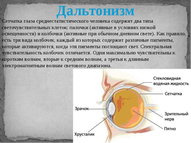 Прочитайте текст сетчатка глаза. Строение глаза дальтоника. Строение глаза при дальтонизме. Структура глаза дальтоника. Строение сетчатки у дальтоников.