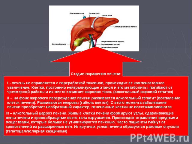 I - печень не справляется с переработкой токсинов, происходит ее компенсаторное увеличение. Клетки, постоянно нейтрализующие этанол и его метаболиты, погибают от чрезмерной работы и их место занимает жировая ткань (алкогольный жировой гепатоз) II - …