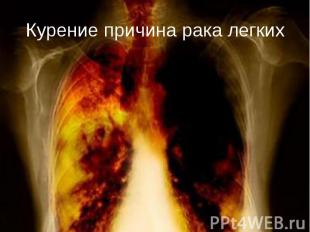Курение причина рака легких