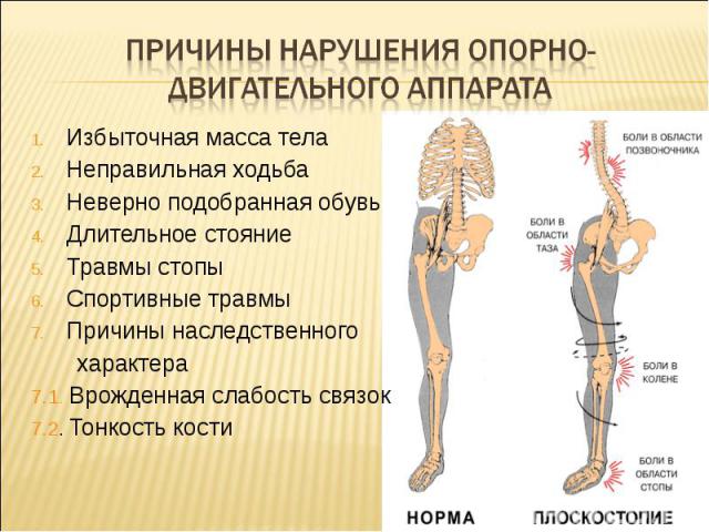 Причины нарушения опорно-двигательного аппарата Избыточная масса телаНеправильная ходьбаНеверно подобранная обувьДлительное стояниеТравмы стопыСпортивные травмыПричины наследственного характера7.1. Врожденная слабость связок7.2. Тонкость кости