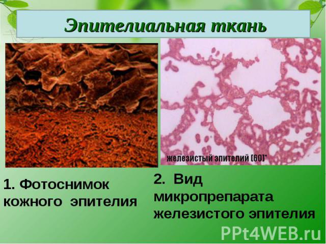 Эпителиальная ткань1. Фотоснимок кожного эпителия2. Вид микропрепарата железистого эпителия