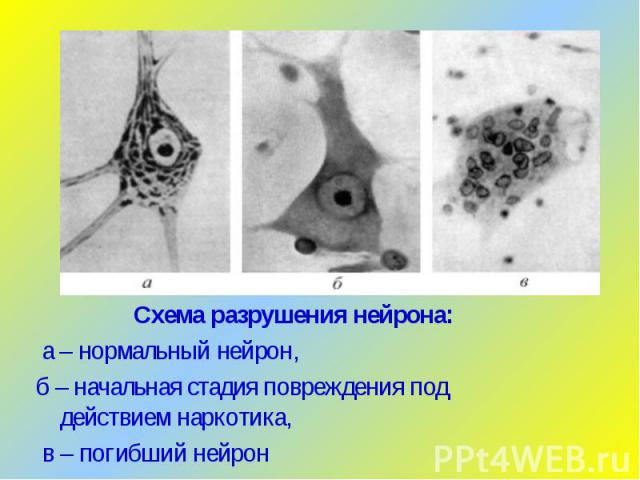 Схема разрушения нейрона: а – нормальный нейрон, б – начальная стадия повреждения под действием наркотика, в – погибший нейрон