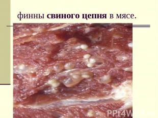 финны свиного цепня в мясе.