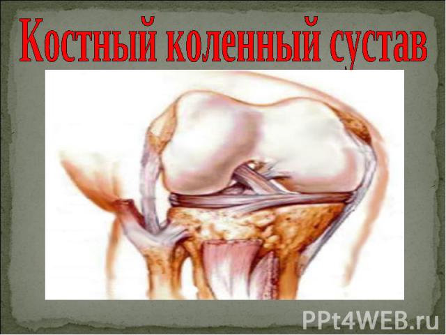 Костный коленный сустав
