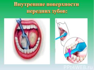 Внутренние поверхности передних зубов: