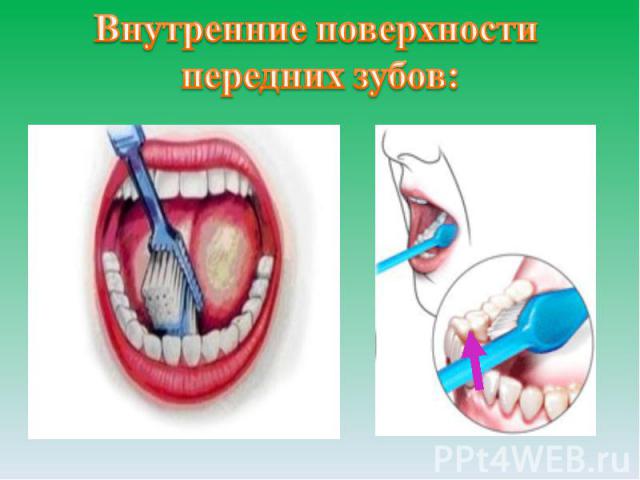 Внутренние поверхности передних зубов: