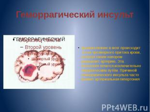 Геморрагический инсульт Кровоизлияние в мозг происходит из-за чрезмерного приток