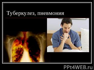 Туберкулез, пневмония