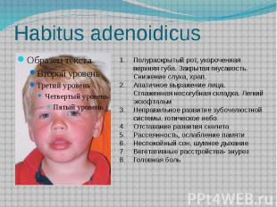 Habitus adenoidicus
