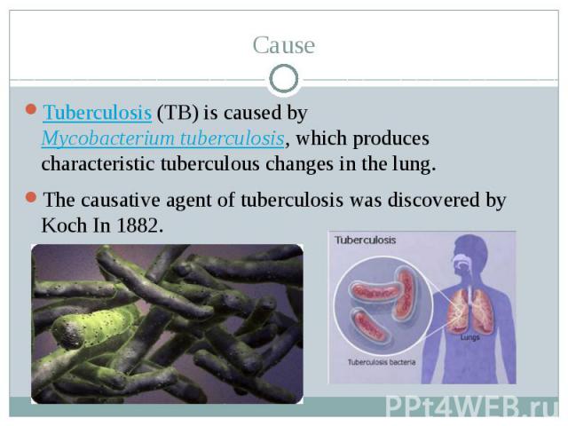 Cause Tuberculosis (TB) is caused by Mycobacterium tuberculosis, which produces characteristic tuberculous changes in the lung. The causative agent of tuberculosis was discovered by Koch In 1882.