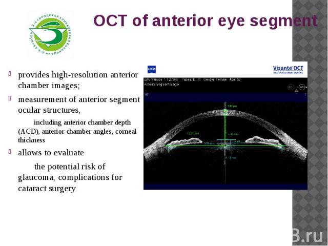 OCT of anterior eye segmentprovides high-resolution anterior chamber images;measurement of anterior segment ocular structures,including anterior chamber depth (ACD), anterior chamber angles, corneal thicknessallows to evaluatethe potential risk of g…